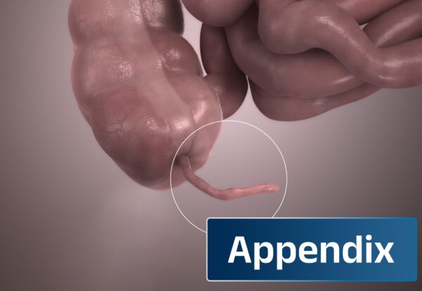 Laparoscopic Appendicectomy The Fastest, Safest & Most Effective Treatment for Appendicitis Laparoscopic Appendicectomy The Fastest, Safest & Most Effective Treatment for Appendicitis